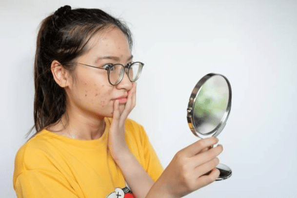 Multi-Omics Comparison of Facial Skin Microbiome Data by Acne Status in Puberty